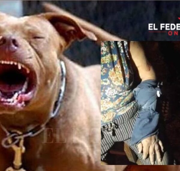 Una mujer fue atacada por tres perros pitbull y los vecinos piden que los saquen del barrio Virgen de los Cerros I