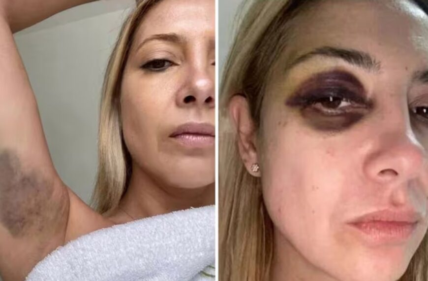 Las fotos y chats del horror: La denuncia de Fabiola Yañez contra Alberto Fernández: “Venís golpeándome hace tres días seguidos”