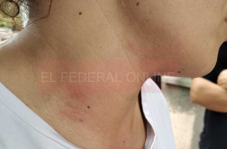 Otro violento arrebato en la capital: una mujer fue arrastrada para robarle la riñonera