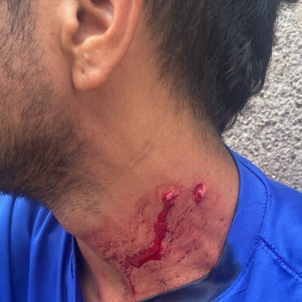 Emergencia médica en la avenida 1 de Marzo: un joven se autolesionó tras discutir con su madre 