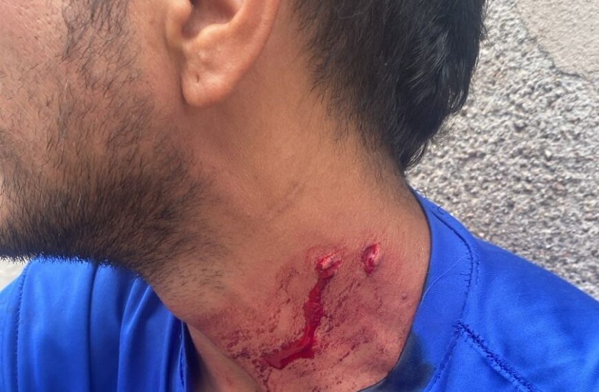 Emergencia médica en la avenida 1 de Marzo: un joven se autolesionó tras discutir con su madre 